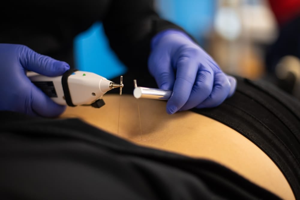Spinal Cord Stimulation (SCS) Treatments in New Jersey and Pennsylvania
